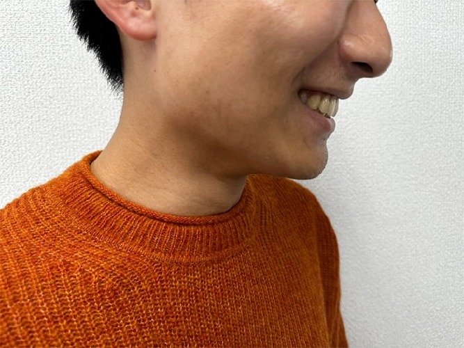 編集部林